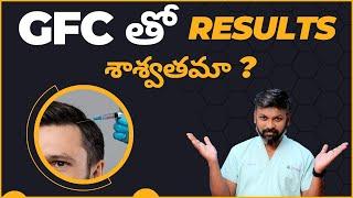 #AskDrJohnWatts | GFC తో RESULTS శాశ్వతమా ? | Best Hair Specialist  Explains