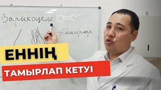 Еркектер біле жүрмейтін Варикоцеле ауруы! Еннің тамырлап кетуі! Ұрық сапасының төмендеуі