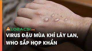 Virus đậu mùa khỉ lây lan, WHO sắp họp khẩn