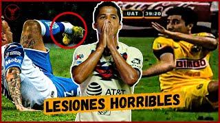 TOP 5 PEORES LESIONES en la LIGA MX