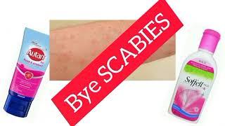 Scabies Sembuh Dengan Autan | Gatal Kulit |  Viral !! Cyntana Family