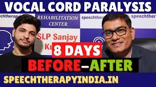 Before-After | Unilateral Vocal Cord Paralysis, Phonatory Gap | 8 Days Treatment | #slpsanjaykumar