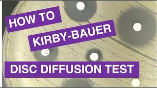 Disc Diffusion (Kirby-Bauer) Antimicrobial Susceptibility Testing