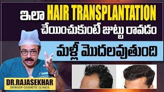 Dr. Rajasekar’s Hair Transplantation Expertise | Sriroop Cosmetic Clinic | #sumantvworld