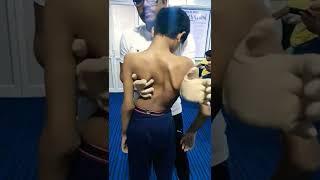 Scoliosis treatment