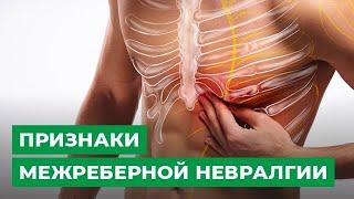 Признаки межреберной невралгии