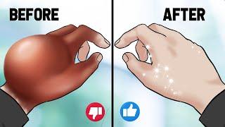 [ASMR Animation] Treatment of wounds on the back of the hand