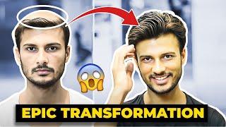 Non Surgical Hair Replacement - Hair Patch/Wigs For Men In India