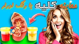 بیماری کلیه | تست سلامت کلیه فقط با رنگ ادرار | تشخیص بیماری کلیه