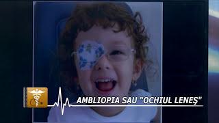 Ambliopia (ochiul lenes) explicata de oftalmolog (VII)