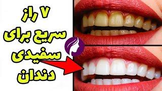  سفیدی دندان با 7 روش سریع و کاربردی  از بین بردن زردی دندان خانم ها و آقایان