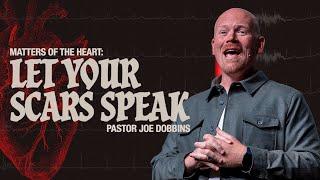 Matters of the Heart: Let Your Scars Speak | Pastor Joe Dobbins | Full Sunday Service