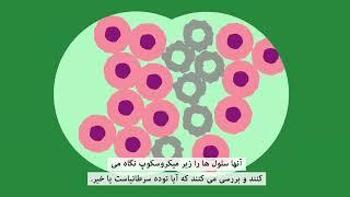 What is cancer? (Farsi) | سرطان چیست؟ (فارسی) | Macmillan Cancer Support