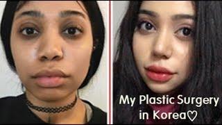 Best Korean Plastic Surgery Clinic, Rhinoplasty & Facial Contouring Surgery Review