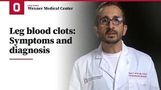 Leg blood clots: Symptoms and diagnosis | Ohio State Medical Center