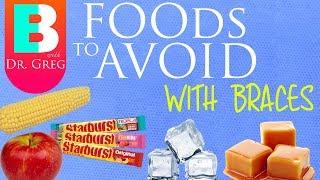 Foods to Avoid with Braces and Why