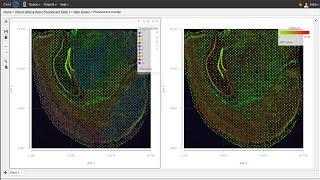 How to Analyze 10x Visium Spatial Gene Expression Data