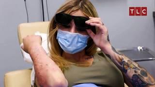 A Patient’s Final Hope in Dr. Lee’s Hands! | Dr Pimple Popper TLC