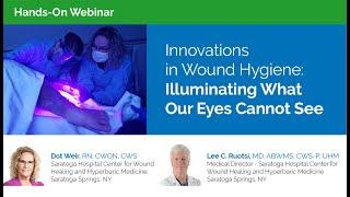 Wound Hygiene Hands-on Webcast: Illuminating What Our Eyes Cannot See