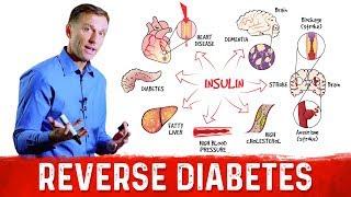 How to Reverse Damage from Diabetes?  – Dr.Berg on Reversing Diabetes