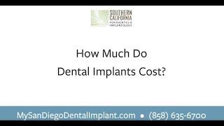 How much do dental implants cost?  | Southern California Periodontics & Implantology | San Diego