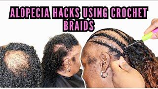 Simple Crochet Braids Hacks For Clients With Alopecia | How To Cover Bald Thin Edges and Crown