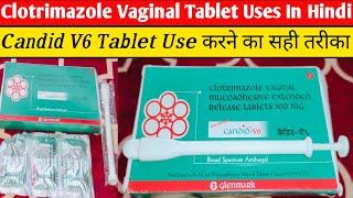 How to Use Clotrimazole Vaginal Tablet / Candid V6 Tablet Kaise Use Kare In Hindi