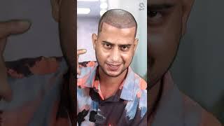 YouTuber Mehtab Saifi Hair Transplant Result | Before & After Hair Transplant #shorts #viral