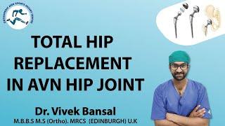 AVN Hip# Uncemented Total Hip replacement# Dr Vivek Bansal# Transforming Life