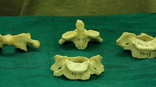 Vertebrae - How to differentiate them...