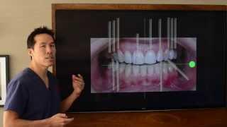 Cosmetic Dentistry - Designing a Perfect Smile