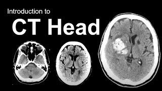 Introduction to CT Head: Approach and Principles