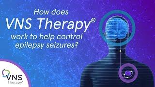 How does VNS Therapy Epilepsy Treatment Work?