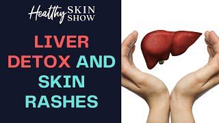 Liver DETOX - Skin Rash Connection, Part 1 | Jennifer Fugo