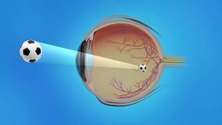 Realities of Corneal Disease