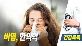 비염, 한방으로 살펴보기 - 2018 0820 건강톡톡 아침이 좋다