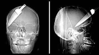 xray project