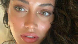 ღ your nostrils are so narrow! ~ alar base reduction procedure 