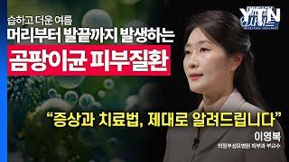 [메디컬 인사이트 37회] 피부과 전문의가 전하는 '곰팡이균 피부질환의 증상과 치료법' / YTN