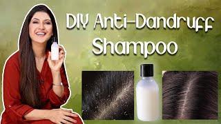 DIY Anti-Dandruff Shampoo For Winter - Ghazal Siddique