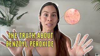 Can you clear your ACNE with Benzoyl Peroxide? (THIS WILL SHOCK YOU)