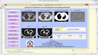 Lung Cancer Detection and Classification Using Neural Network Matlab Project Source Code