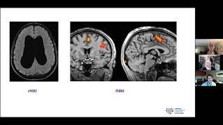 "Neuroimaging of ADHD: Crisis and Opportunity" | Francisco X. Castellanos, MD