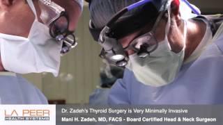 Thyroidectomy Thyroid Surgery Performed by Dr. Zadeh