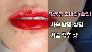 맞춤형 오버립 (풀립) 상담시술 _ 제이엠뷰티솔루션스 / JM뷰티솔루션스 / JM beauty solutions