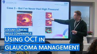 How to use OCT for glaucoma management