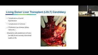 Live Donor Liver Transplantation in BC