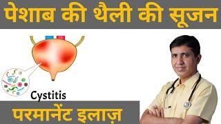 Cystitis | Bladder Pain |Pesab Ki Theli Ki Sujan | Pesab Khulkar Nahi Aana | Homeopathy For Cystitis