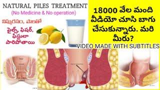 Piles, Fissures, and Fistula Treatment at Home in Telugu | Telugu Tips