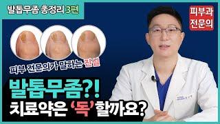 발톱무좀 치료약은 간에 나쁘다⁉ ㅣ발톱무좀 치료의 오해와 진실